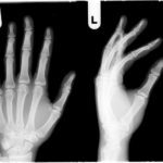 left hand exray facing and side views